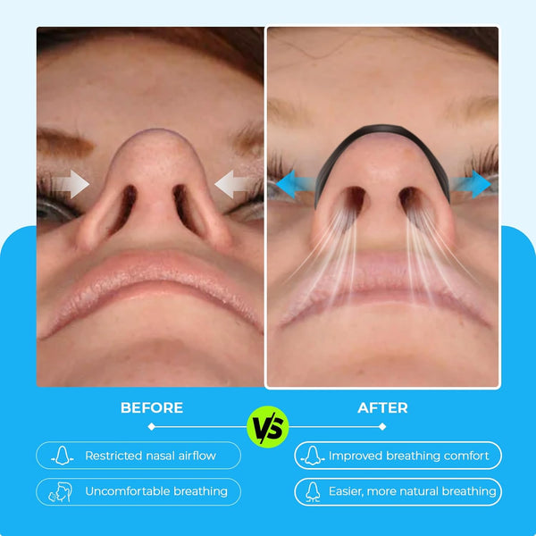 Easy Breathe Nasal Strips Kit
