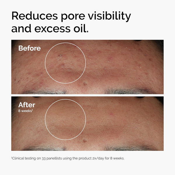 Radiant Skin Blemish Serum